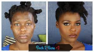 acne e hyperpigmented dark skin
