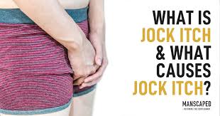 Treatment may involve keeping the groin area clean and dry and applying topical antifungal medications to the. What Is Jock Itch And What Causes Jock Itch Manscaped