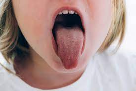 what causes tingling tongue signs of