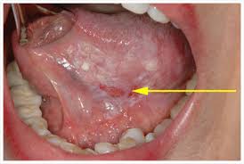 treatment of mouth and jaw diseases