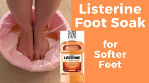 listerine foot soak for softer feet