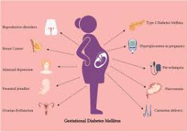 gestational diabetes mellitus a