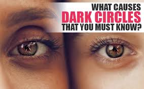 dark circle under eye