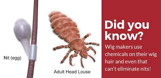 To make it clear, we will explain how coloring hair can affect this critter. Does Coca Cola Kill Head Lice The Answer Might Surprise You Pest Strategies