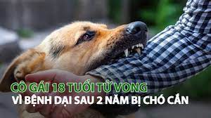 Cô gái 18 tuổi tử vong vì bệnh dại sau 2 năm bị chó cắn