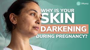 skin darkening during pregnancy