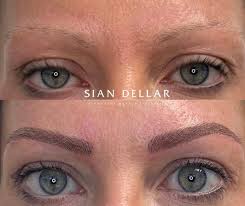 eyebrow restoration treat yourself or