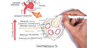 Nephrotic Syndrome Types And Pathology Histology