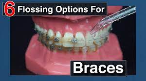 Carefully thread it under or over the main wire of your braces, taking care not to get it stuck. How To Floss With Braces Youtube