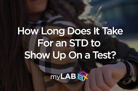 How Long For Stds To Show On Test Results Std Incubation