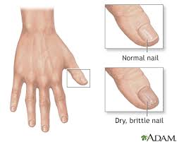 nail abnormalities information mount