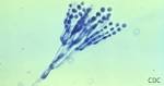 「プベルル酸」とは 青カビで発見、抗菌作用と毒性 - 日本経済新聞