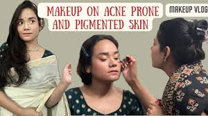 makeup on acne e skin party makeup