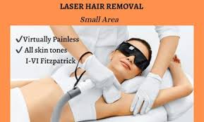 ventura laser hair removal deals in