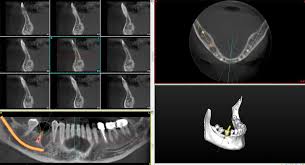 digital dentistry in bentonville ar