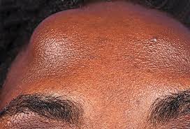 pictures of skin diseases and problems
