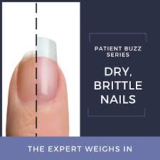 patient buzz dry brittle nails the