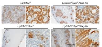 antigen retrieval buffer 100x citrate