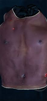 bullet wound on chest extreme simulations