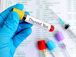 Tsh Thyroid Stimulating Hormone Test