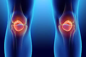 meniscus tear prp and stem cell therapy