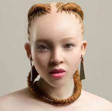 South African United Albinism Community Pageant - Publicaciones | Facebook