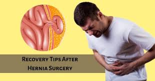 10 recovery tips after hernia surgery