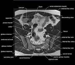 mri pelvis anatomy free male pelvis