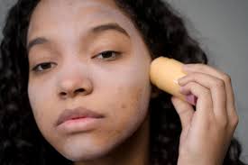 comment reconnaître l acné hormonale