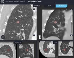 Lungvision Real Time Imaging For Ground