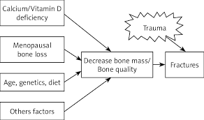 Pathophysiology Of Osteoporosis Related Fractures Download