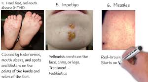 skin rash in kids red spots on skin
