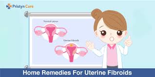 home remes for uterine fibroids