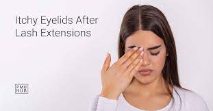 get blepharitis from eyelash extensions