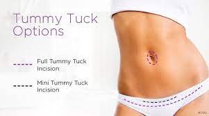 gaining weight after a tummy tuck what