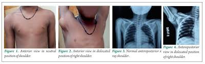 International Journal of Surgical Cases