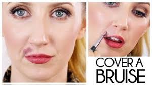 how to cover a bruise with makeup that
