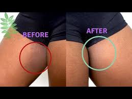 clear inner thighs fast diy you