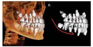 cbct imaging in orthodontics