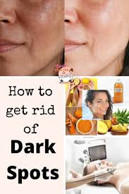 how to get rid of dark spots on face