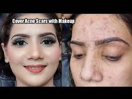 bridal makeup base for acne e skin