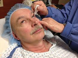 cataract surgery complications and