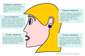 Migraine Headache Diagram Headache_diagram Headache