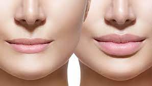 your lips from thinning with age