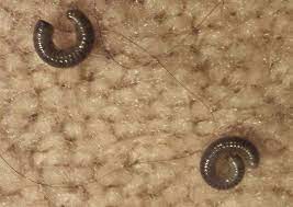 How To Get Rid Of Millipedes In 3 Easy