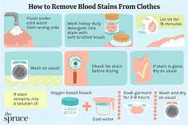 how to remove bloodstains from clothes