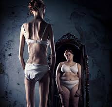 Resultado de imagen de anorexia idealizada