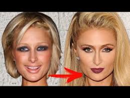 Paris Hilton Change From Childhood To 2017