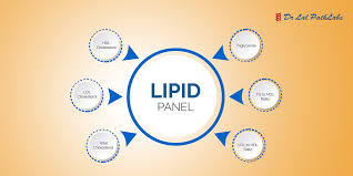 lipid profile test purpose procedure