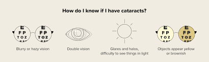 cataracts after lasik eye surgery what